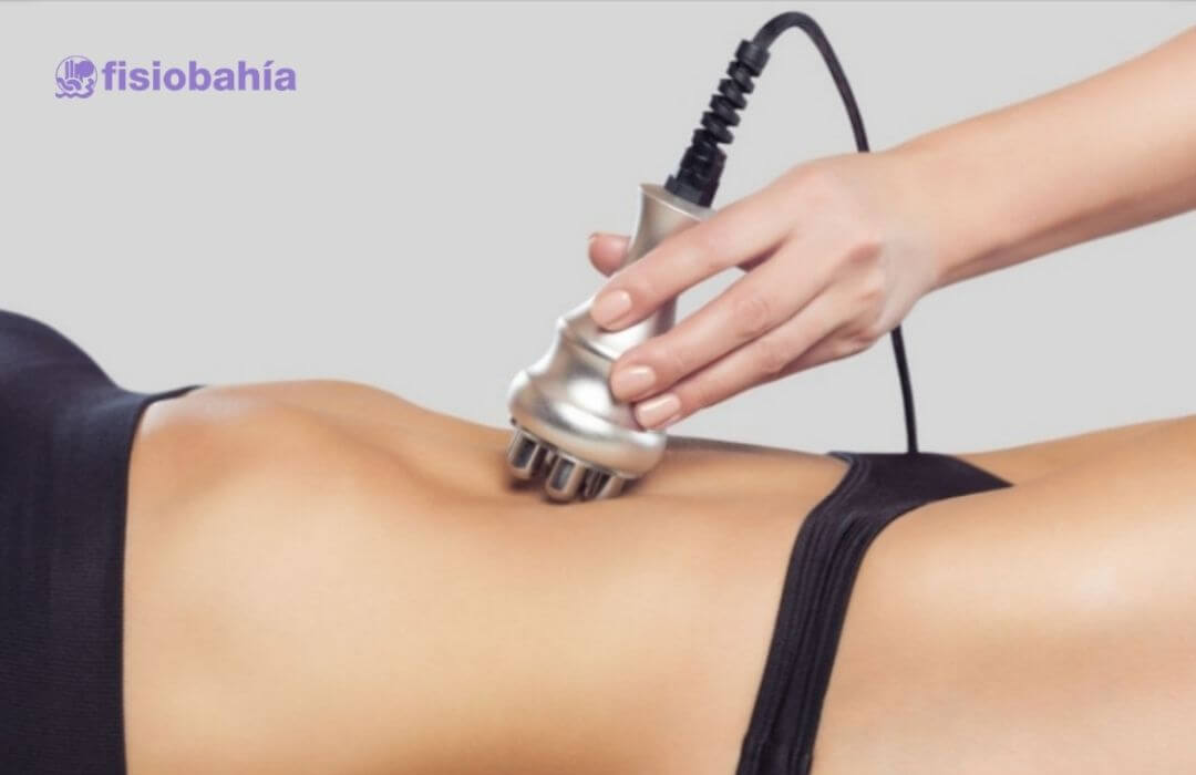 Fisioestética