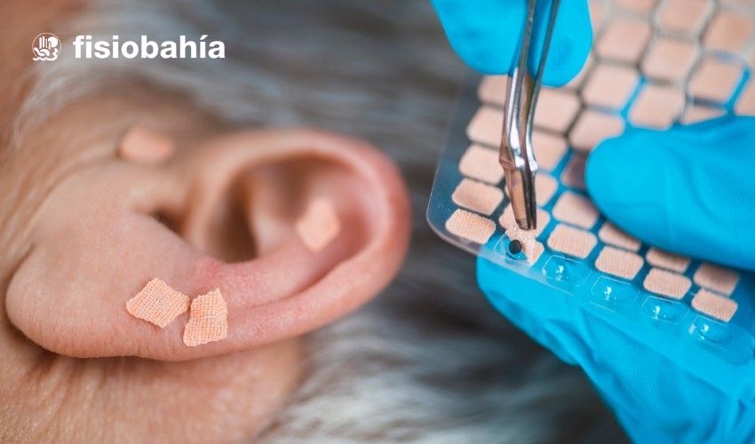 ¿Qué es la auriculoterapia?