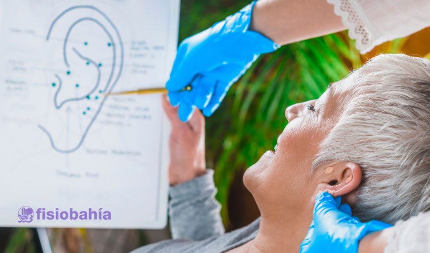 ¿Cuánto dura el tratamiento con auriculoterapia?