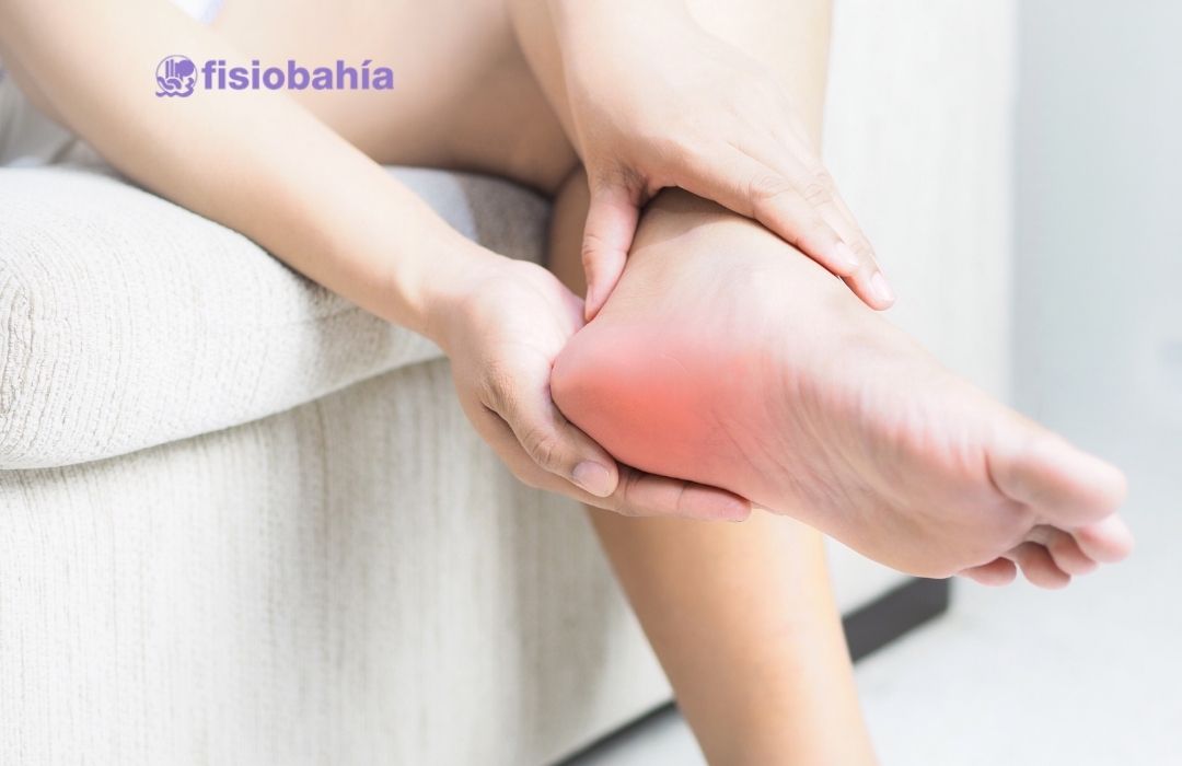 Síntomas de la fascitis plantar