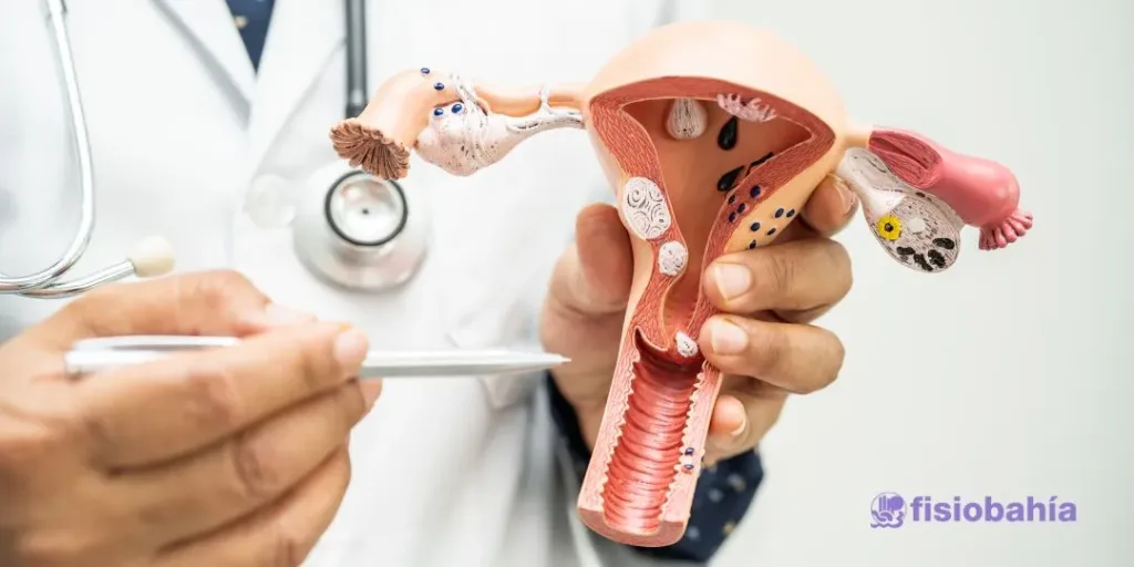 ¿Qué tratamiento debo realizar si se me diagnostica un prolapso?